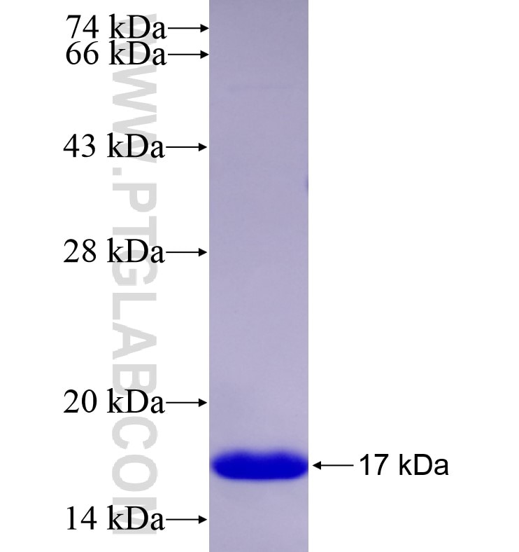 FOXP2 fusion protein Ag16559 SDS-PAGE