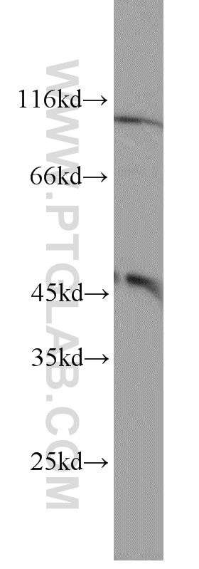 Western Blot (WB) analysis of HEK-293 cells using FOXP3 Polyclonal antibody (22173-1-AP)