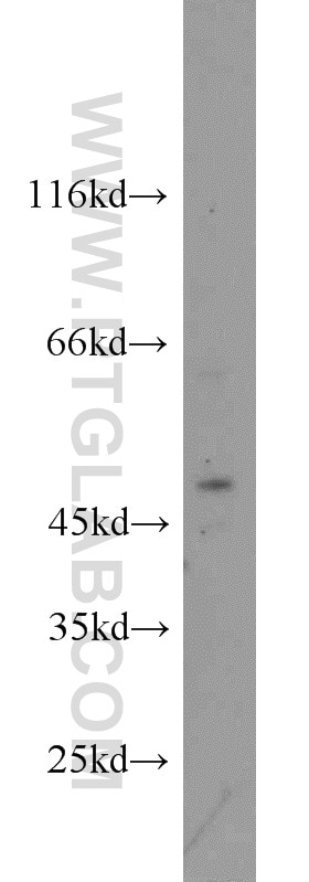 Western Blot (WB) analysis of HEK-293 cells using FOXP3 Polyclonal antibody (22173-1-AP)