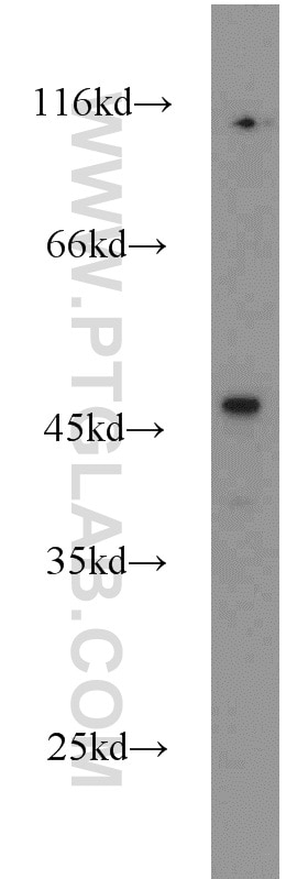 Western Blot (WB) analysis of A375 cells using FOXP3 Polyclonal antibody (22173-1-AP)