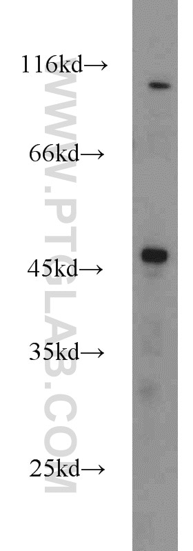 Western Blot (WB) analysis of HEK-293 cells using FOXP3 Polyclonal antibody (22173-1-AP)