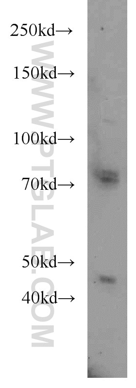 Western Blot (WB) analysis of HeLa cells using FOXP3 Polyclonal antibody (22173-1-AP)