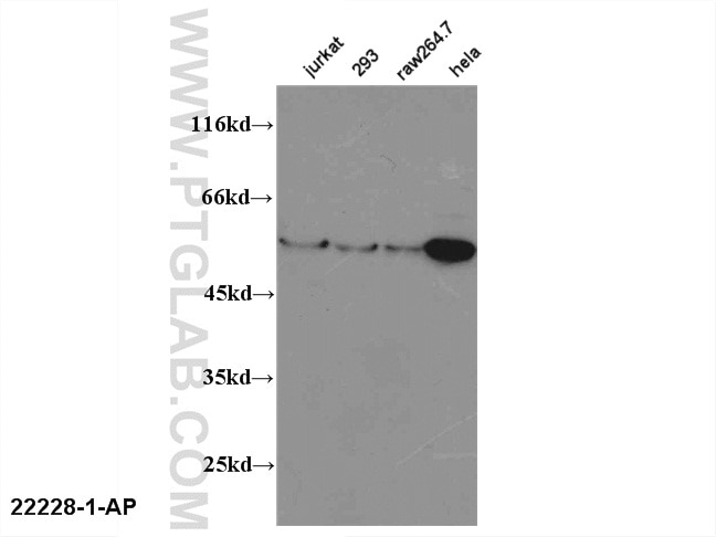 Western Blot (WB) analysis of multi-cells using FOXP3 Polyclonal antibody (22228-1-AP)