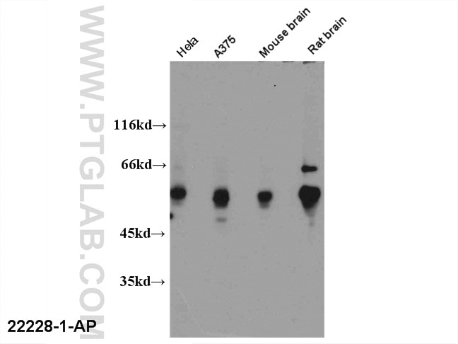 Western Blot (WB) analysis of multi-cells/tissue using FOXP3 Polyclonal antibody (22228-1-AP)
