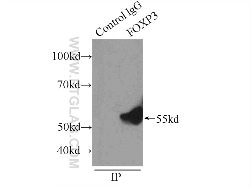 IP experiment of HeLa using 22228-1-AP