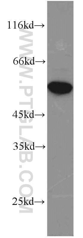 Western Blot (WB) analysis of HeLa cells using FOXP3 Polyclonal antibody (22228-1-AP)