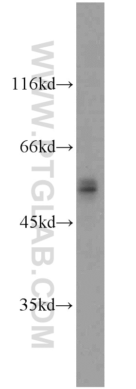 Western Blot (WB) analysis of A375 cells using FOXP3 Polyclonal antibody (22228-1-AP)