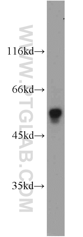 Western Blot (WB) analysis of mouse brain tissue using FOXP3 Polyclonal antibody (22228-1-AP)