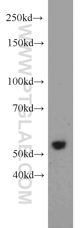 Western Blot (WB) analysis of HEK-293 cells using FOXP3 Polyclonal antibody (22228-1-AP)