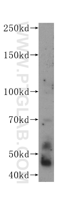 Western Blot (WB) analysis of HEK-293 cells using FOXP3 Monoclonal antibody (60149-1-Ig)