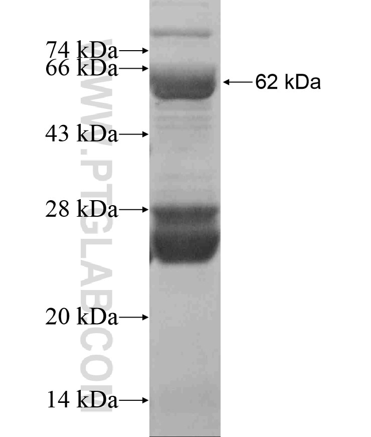 FOXP3 fusion protein Ag17571 SDS-PAGE