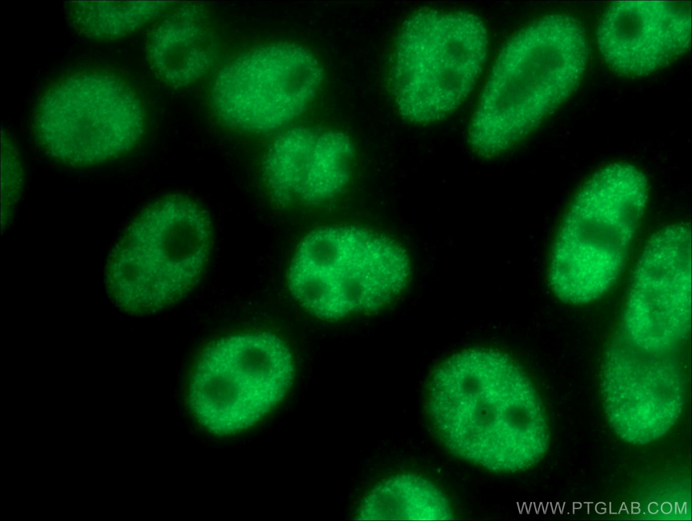Immunofluorescence (IF) / fluorescent staining of HepG2 cells using FOXP4 Polyclonal antibody (16772-1-AP)
