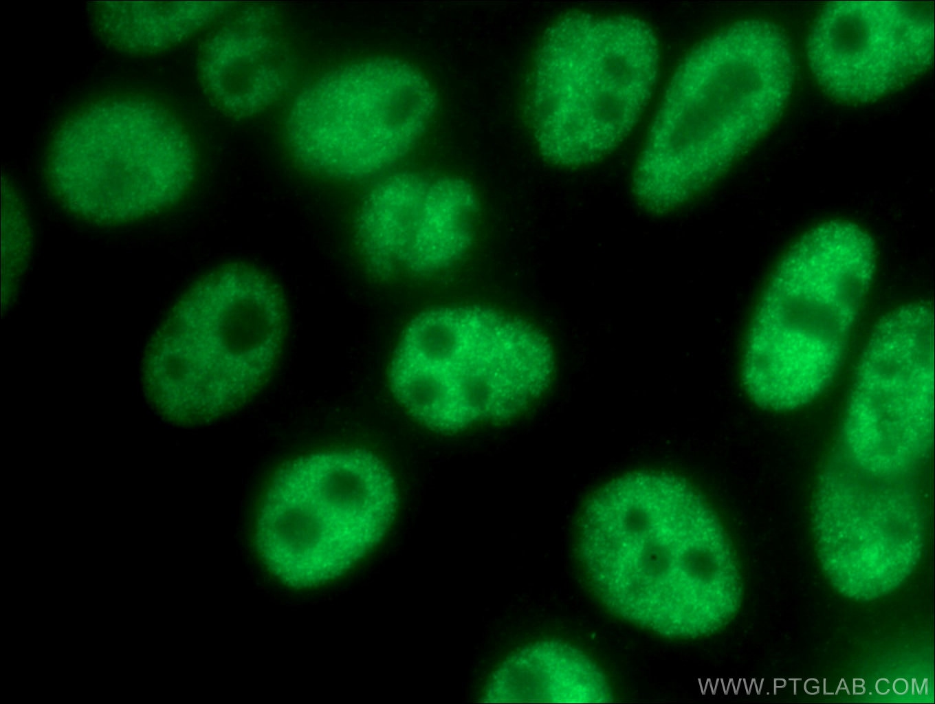 Immunofluorescence (IF) / fluorescent staining of HepG2 cells using FOXP4 Polyclonal antibody (16772-1-AP)