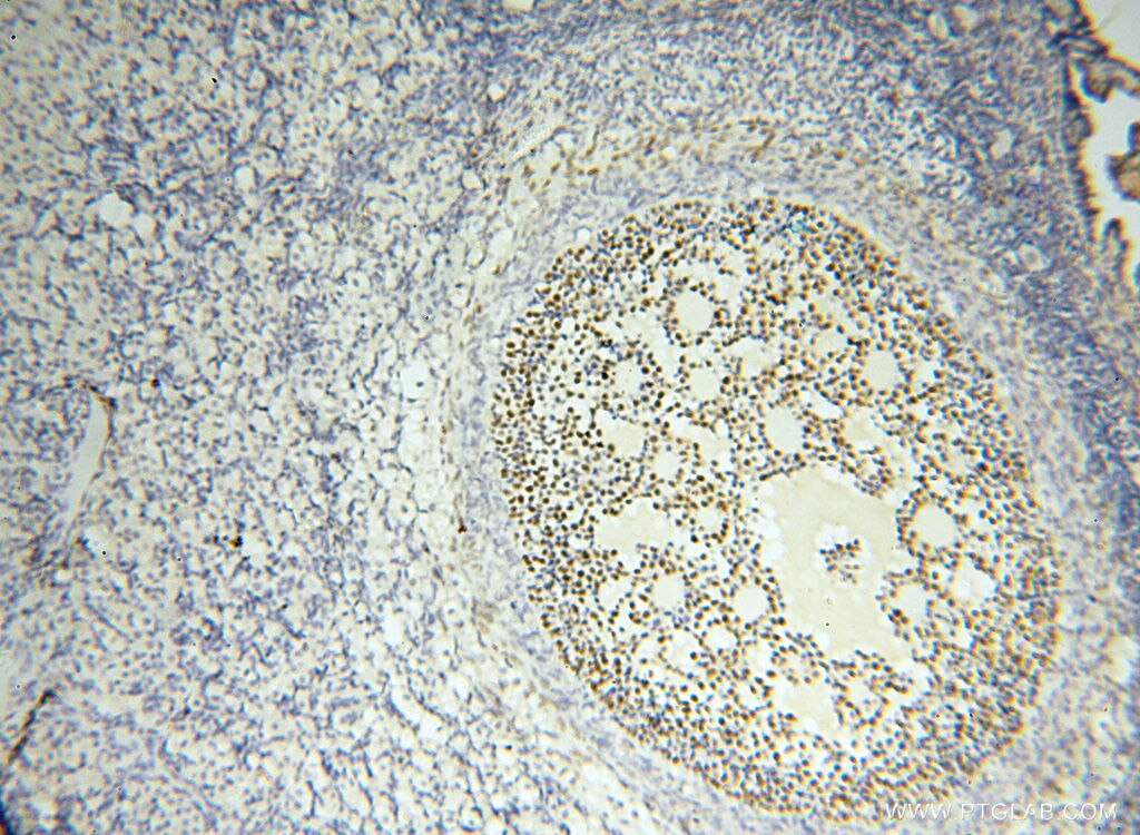Immunohistochemistry (IHC) staining of human ovary tissue using FOXP4 Polyclonal antibody (16772-1-AP)