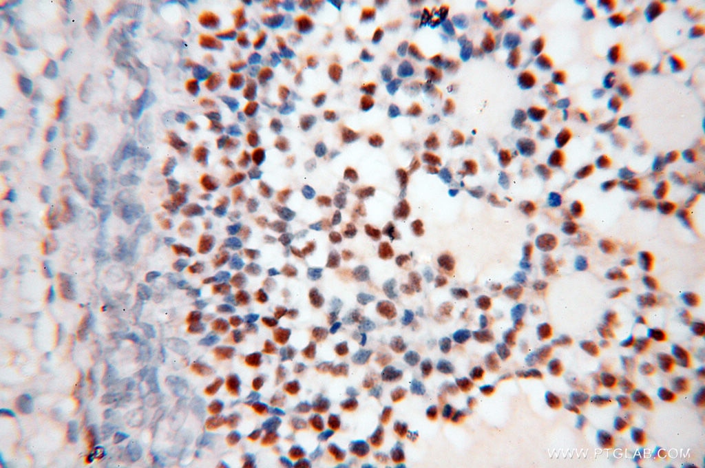 Immunohistochemistry (IHC) staining of human ovary tissue using FOXP4 Polyclonal antibody (16772-1-AP)