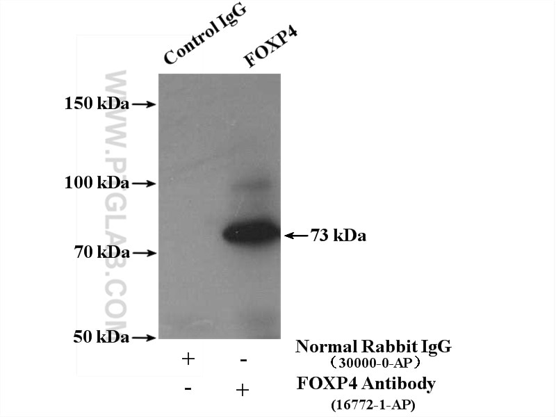 Immunoprecipitation (IP) experiment of mouse lung tissue using FOXP4 Polyclonal antibody (16772-1-AP)