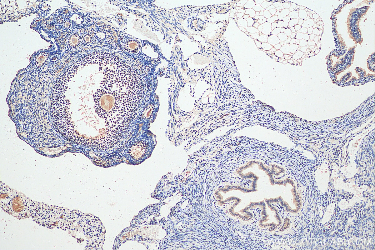 IHC staining of mouse ovary using 29311-1-AP