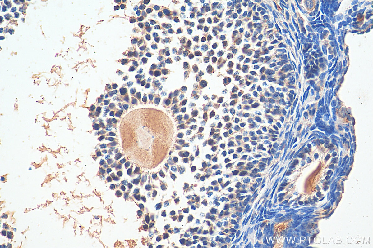 Immunohistochemistry (IHC) staining of mouse ovary tissue using FOXP4 Polyclonal antibody (29311-1-AP)