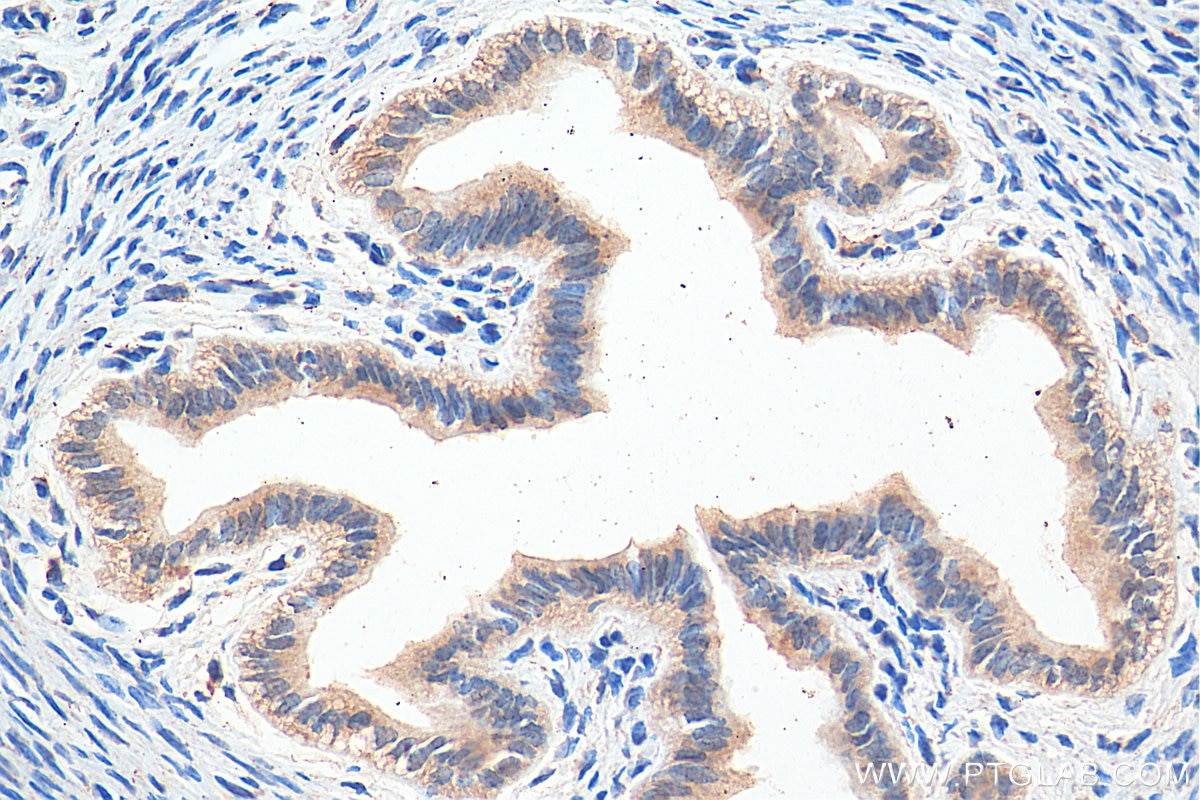 Immunohistochemistry (IHC) staining of mouse ovary tissue using FOXP4 Polyclonal antibody (29311-1-AP)