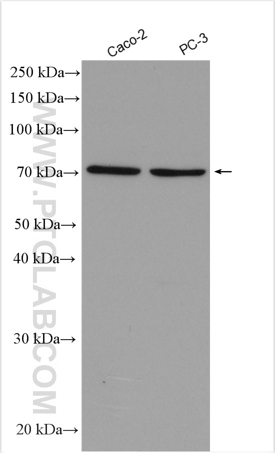 Western Blot (WB) analysis of various lysates using FOXP4 Polyclonal antibody (29311-1-AP)