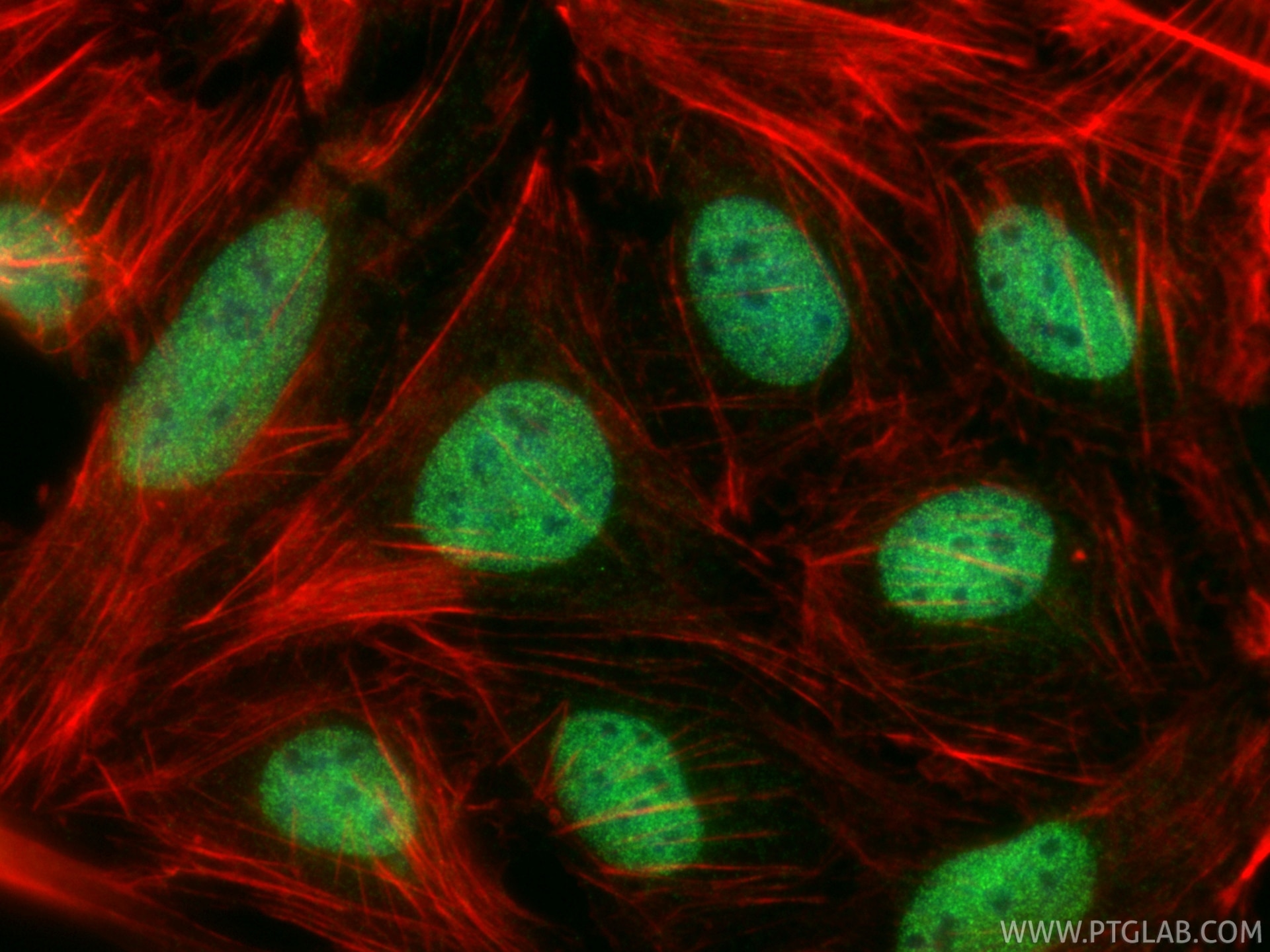 IF Staining of U2OS using 84855-1-RR (same clone as 84855-1-PBS) Immunofluorescence (IF) / fluorescent staining of U2OS cells using FOXP4 Recombinant monoclonal antibody (84855-1-RR)
