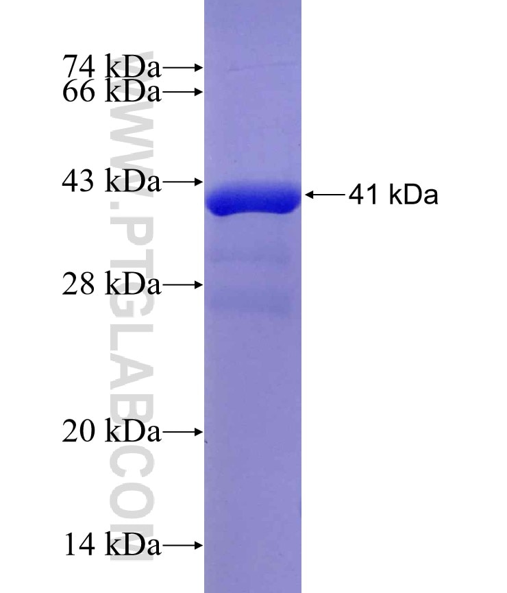 FOXP4 fusion protein Ag29953 SDS-PAGE