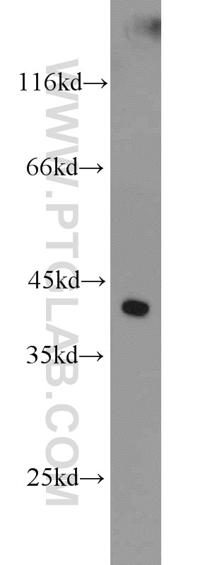 Western Blot (WB) analysis of mouse kidney tissue using FOXQ1 Polyclonal antibody (23718-1-AP)
