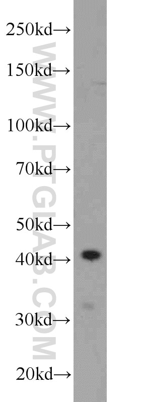 Western Blot (WB) analysis of rat kidney tissue using FOXQ1 Polyclonal antibody (23718-1-AP)