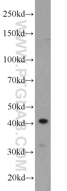 WB analysis of rat kidney using 23718-1-AP