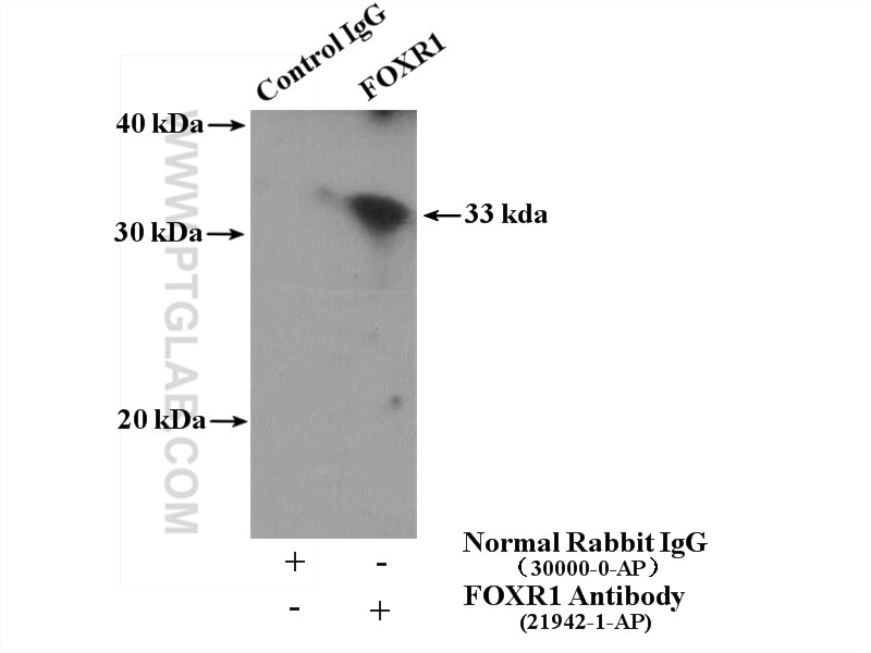 Immunoprecipitation (IP) experiment of mouse brain tissue using FOXR1 Polyclonal antibody (21942-1-AP)