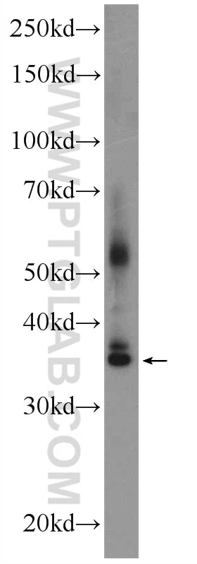 Western Blot (WB) analysis of fetal human brain tissue using FOXR1 Polyclonal antibody (21942-1-AP)