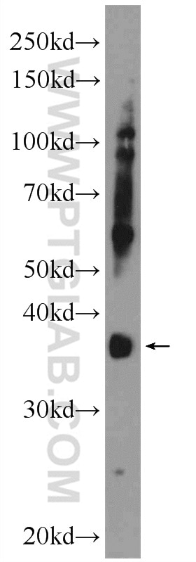 Western Blot (WB) analysis of mouse brain tissue using FOXR1 Polyclonal antibody (21942-1-AP)