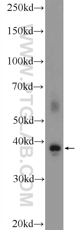 Western Blot (WB) analysis of fetal human brain tissue using FOXR1 Polyclonal antibody (21942-1-AP)