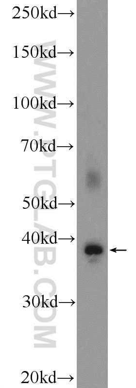 Western Blot (WB) analysis of fetal human brain tissue using FOXR1 Polyclonal antibody (21942-1-AP)