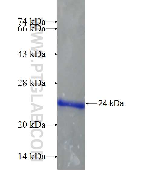 FOXR1 fusion protein Ag16625 SDS-PAGE