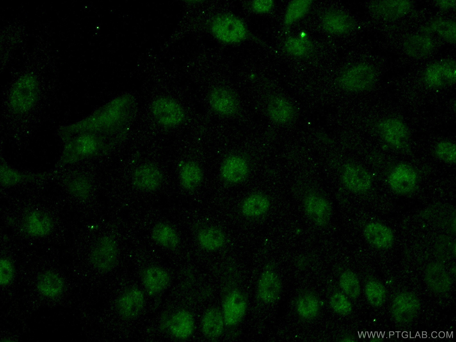 Immunofluorescence (IF) / fluorescent staining of SH-SY5Y cells using FOXR2 Polyclonal antibody (14111-1-AP)