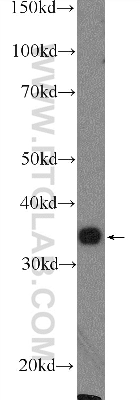 Western Blot (WB) analysis of mouse liver tissue using FOXS1 Polyclonal antibody (16234-1-AP)