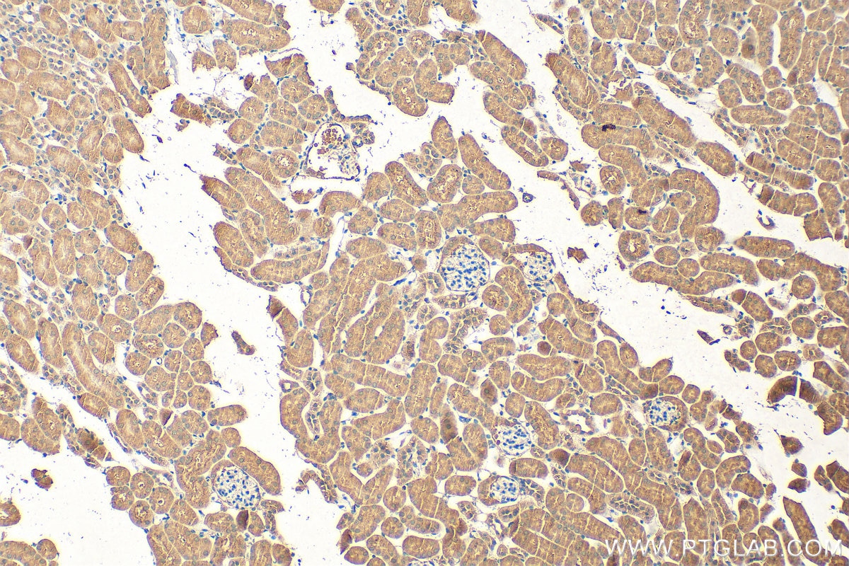 Immunohistochemistry (IHC) staining of mouse kidney tissue using FPGS Polyclonal antibody (27616-1-AP)