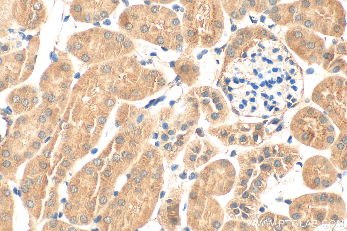 Immunohistochemistry (IHC) staining of mouse kidney tissue using FPGS Polyclonal antibody (27616-1-AP)