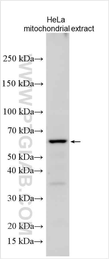 Western Blot (WB) analysis of various lysates using FPGS Polyclonal antibody (27616-1-AP)