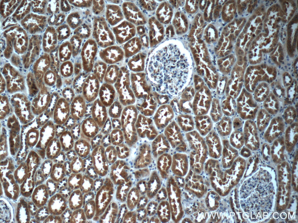 Immunohistochemistry (IHC) staining of human kidney tissue using FPGT Polyclonal antibody (24937-1-AP)