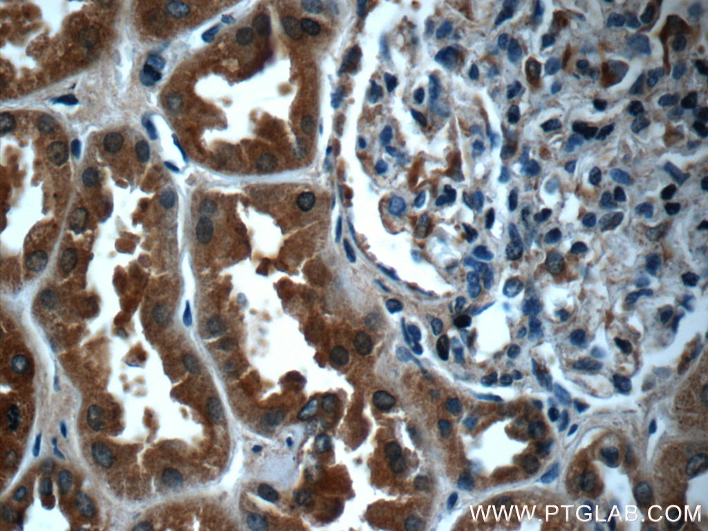 Immunohistochemistry (IHC) staining of human kidney tissue using FPGT Polyclonal antibody (24937-1-AP)