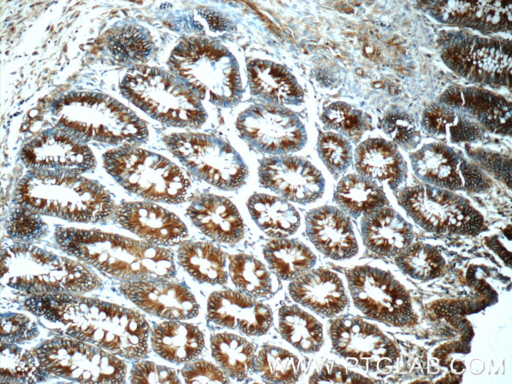 Immunohistochemistry (IHC) staining of human colon tissue using FPGT Polyclonal antibody (24937-1-AP)