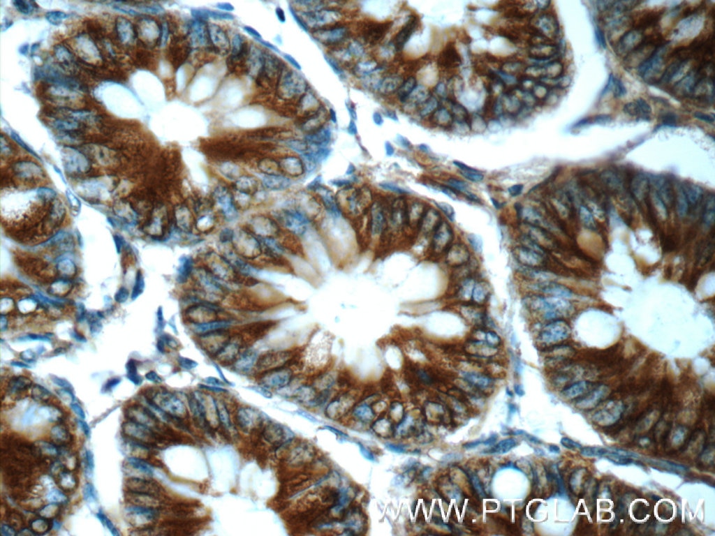 Immunohistochemistry (IHC) staining of human colon tissue using FPGT Polyclonal antibody (24937-1-AP)