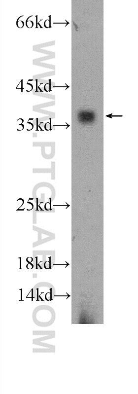 Western Blot (WB) analysis of mouse colon tissue using FPGT Polyclonal antibody (24937-1-AP)