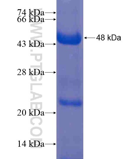 FPGT fusion protein Ag20655 SDS-PAGE