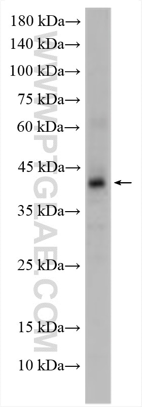 Western Blot (WB) analysis of HEK-293 cells using FPR2 Polyclonal antibody (30989-1-AP)