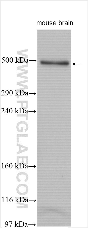 Western Blot (WB) analysis of mouse brain tissue using FRAS1 Polyclonal antibody (29654-1-AP)