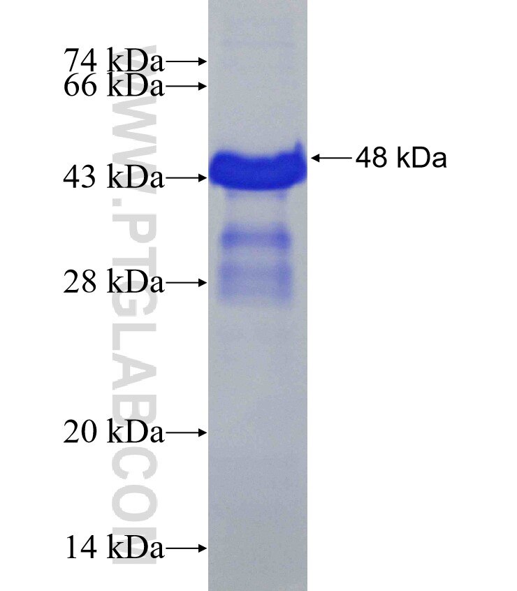 FRAS1 fusion protein Ag31229 SDS-PAGE