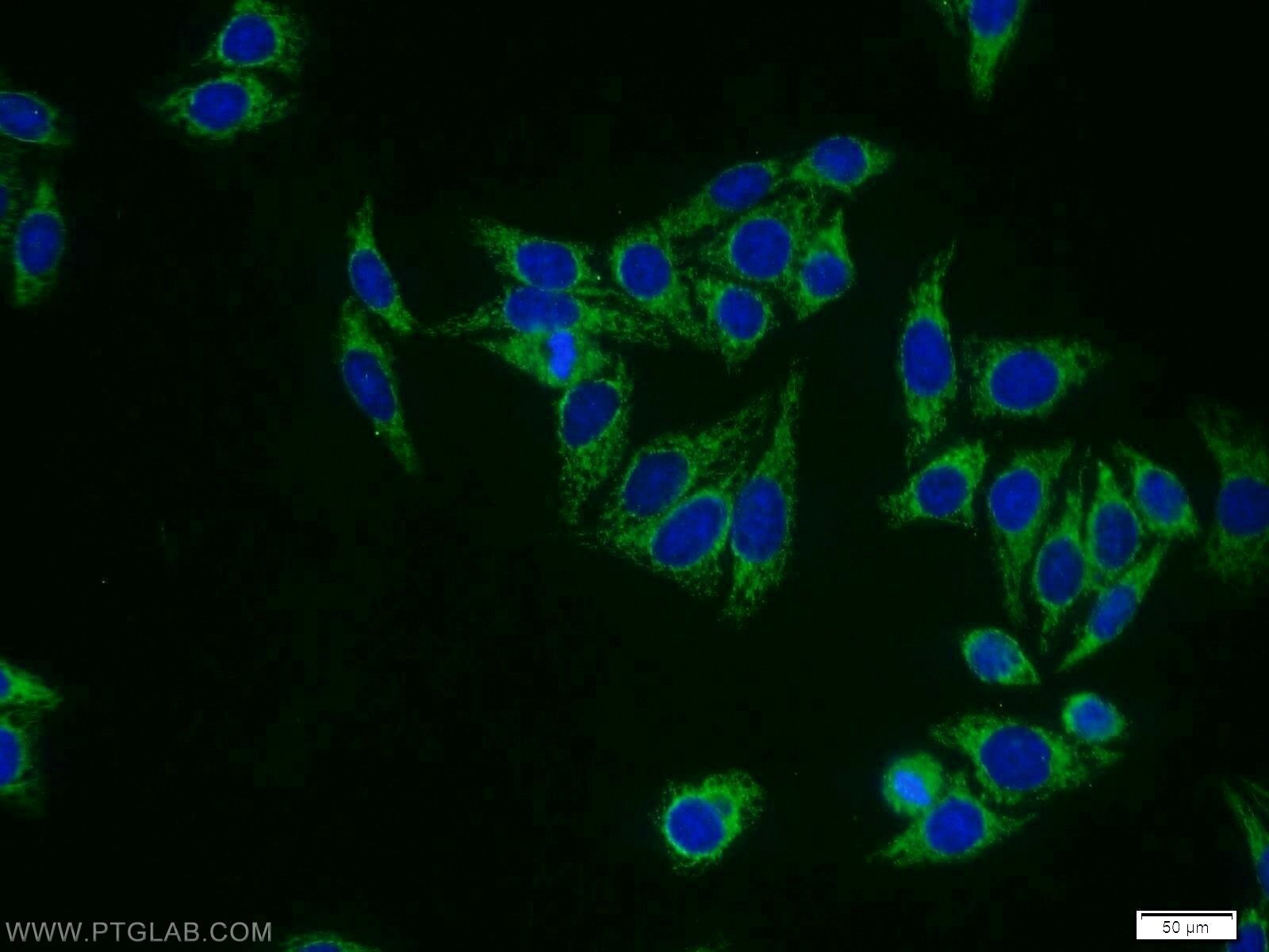 Immunofluorescence (IF) / fluorescent staining of HepG2 cells using FREM1 Polyclonal antibody (13086-1-AP)
